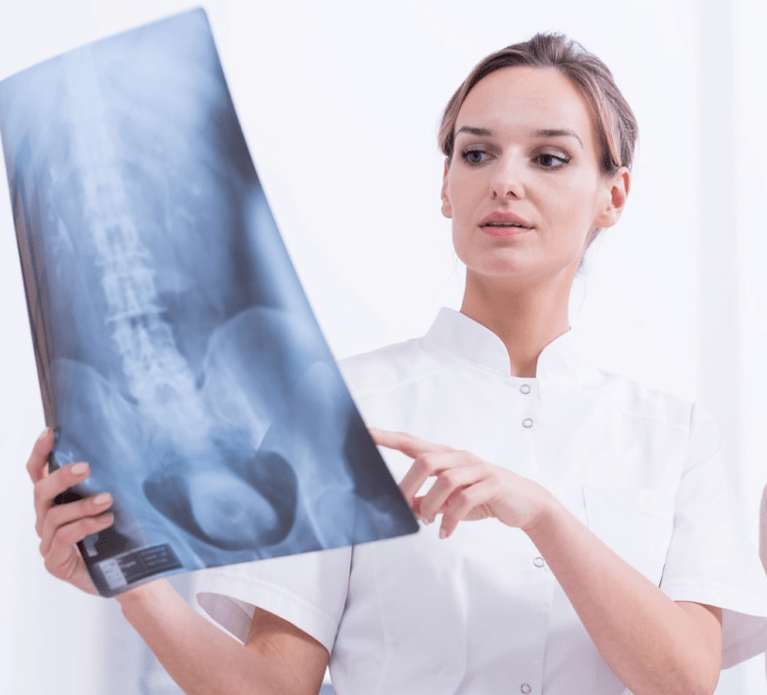 Diagnóstico de osteocondrose torácica por exame de raios X