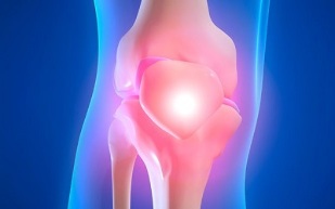 causas da artrose da articulación do xeonllo